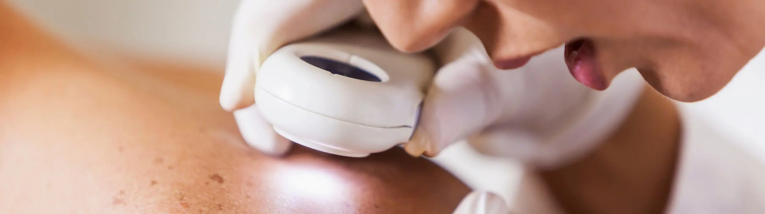 Consulta médica Dermatologista